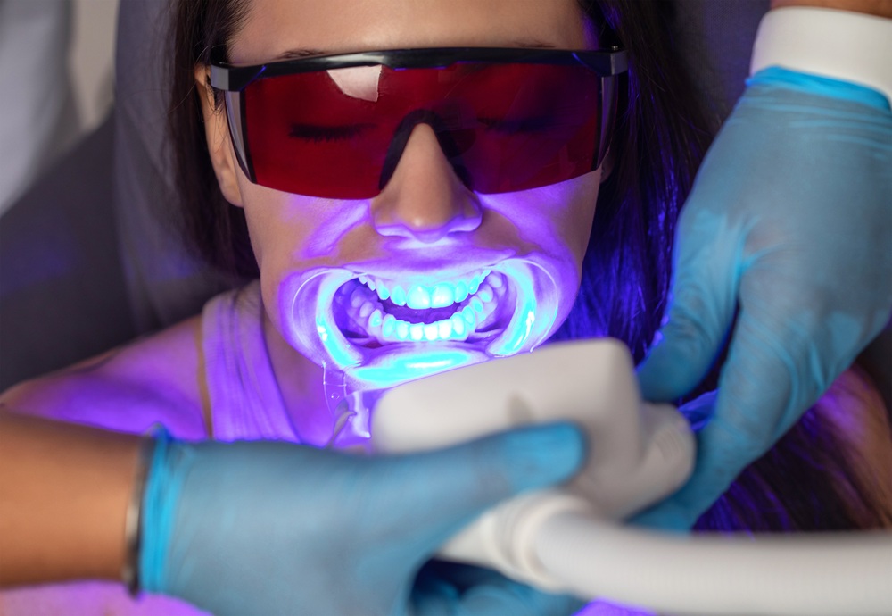Close up of a patient's smile during an in office LED teeth whitening treatment